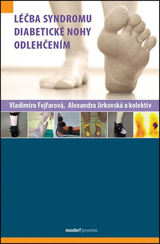 Časově Omezené Léčba syndromu diabetické nohy odlehčením